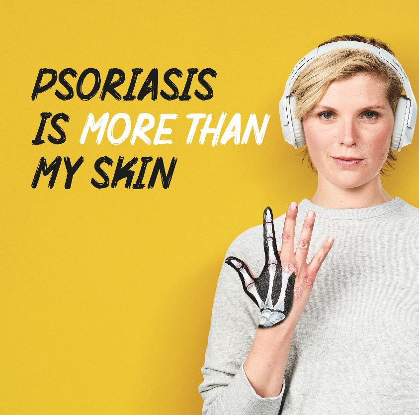 Le psoriasis, c'est plus que ma peau