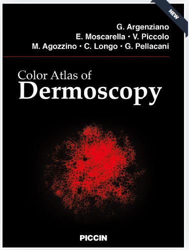Eau Thermale Avène : Demandez votre e-book 'Color Atlas of Dermoscopy' !