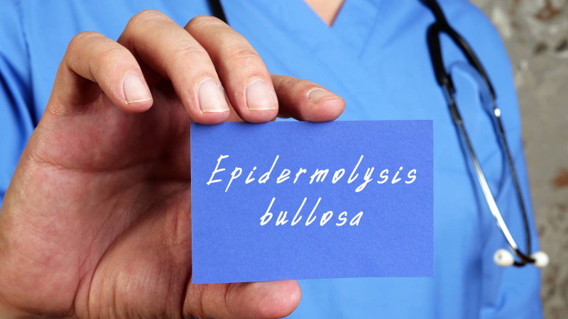 Epidermolysis bullosa